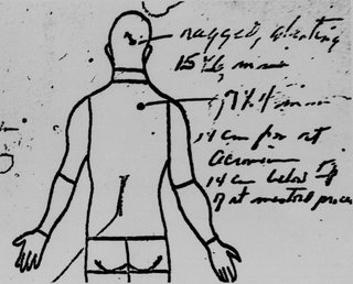 Illustration for article titled Reason for Conspiracy? 5 Mysterious Details From JFK's Autopsy